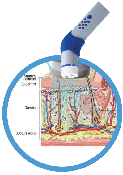 DEP® (Dermoelectroporation®)無針滲透技術